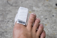 How to Treat a Broken Toe