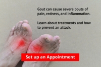 Gout Pain Can Be Managed